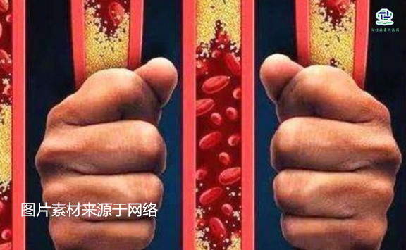 不想給血管&ldquo;添堵&rdquo;，盡量少吃以下這些東西，或許能讓腦梗離遠些  